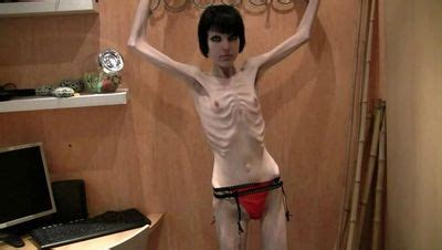 Anorexia Horrific Body Most Skinny Girls In Sex Page Antiq