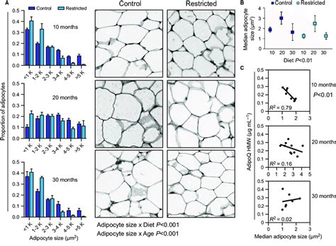 Changes With Adipose Tissue Morphology With Age And Cr A