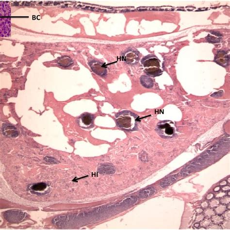 Histological Section Of The Hepatopancreas Of Penaeus Vannamei Showing