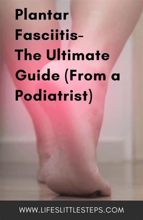 Plantar Fasciitis The Ultimate Guide From A Podiatrist