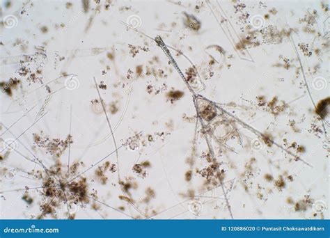 Marine Aquatic Plankton Under the Microscope View Stock Photo - Image ...