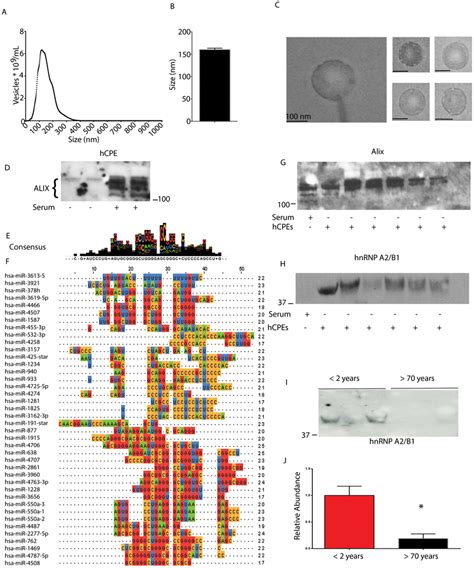 HnRNP A2 B1 Is A Choroid Plexus And CSF Vesicle Protein A