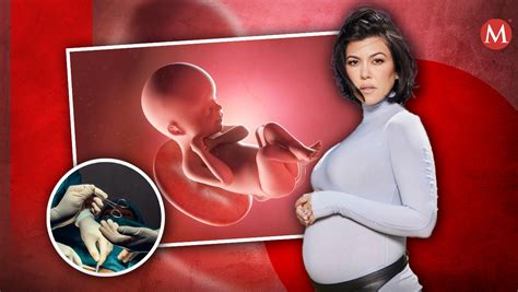 La cirugía fetal que le practicaron a Kourtney Kardashian y su bebé