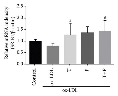 Tetramethylpyrazine Paeoniflorin Pair Increased Cholesterol Efflux