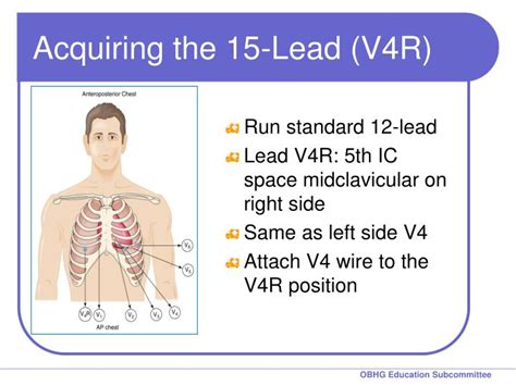 Pediatric 15 Lead ECG Placement