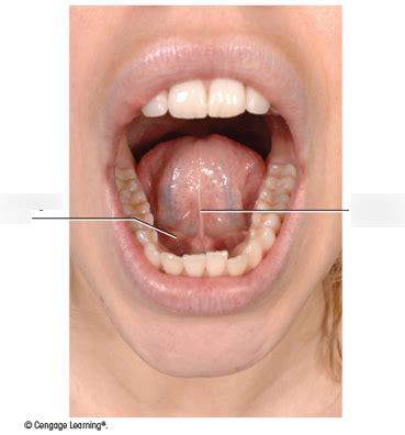 Figure Inferior Surface Of The Tongue Diagram Quizlet