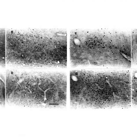 Photomicrographs Of The Effects On C Fos Immunoreactivity In The