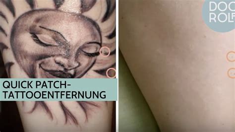 Tattoo Entfernung Mit Dem Quick Patch Tattoos Mal Schneller