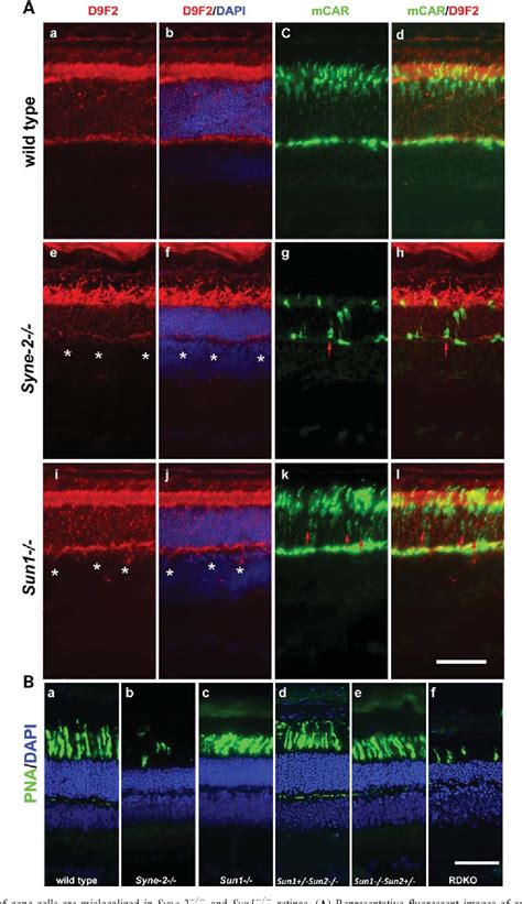 Figure 1 From KASH Protein Syne 2 Nesprin 2 And SUN Proteins SUN1 2