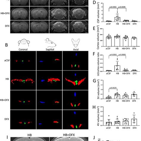 Iron Mediated Choroid Plexus Chp Dysfunction After Intraventricular