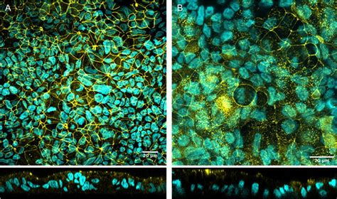 Immunostaining Of Tight Junction Protein ZO 1 Cell Nuclei Are Shown In