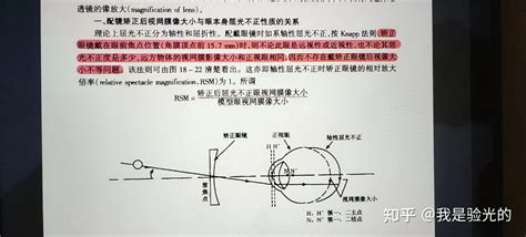 屈光参差与不等像有多少关系 知乎