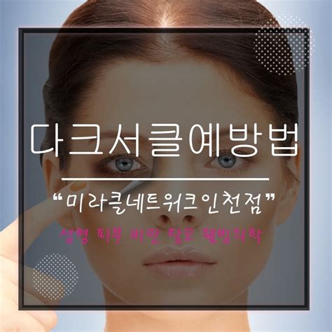 다크서클 생기는 이유 네이버 블로그