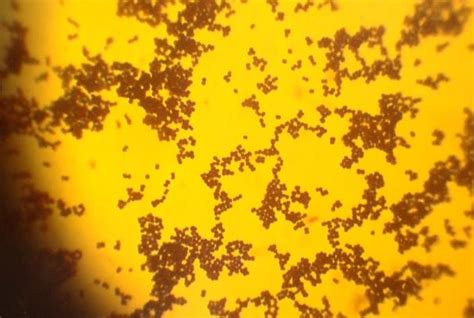 Staphylococcus Aureus Karakteristik Morfologi Patogenesis Biologi