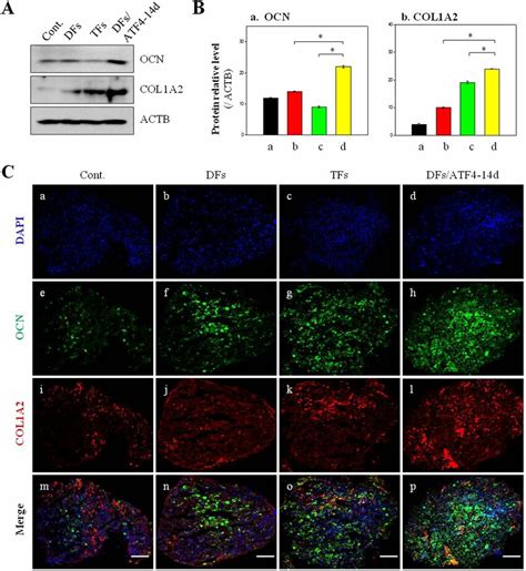 Osteogenesis Of HMSCs Transfected With Two And Three Genes Determined