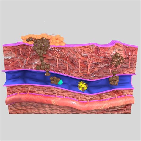 ArtStation - 3D cancer metastasis spread model | Resources