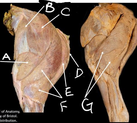 Equine Hindlimb Muscles Diagram Quizlet