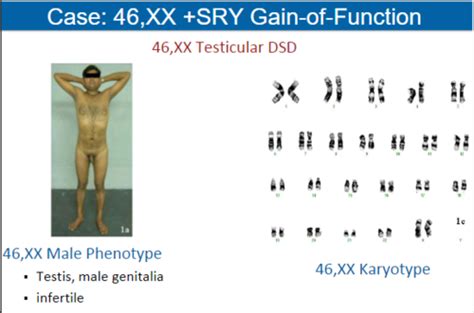 The Sex Chromosomes Flashcards Quizlet