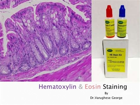 What Colour Does Haematoxylin Stain Structures - Karin Good Bruidstaart