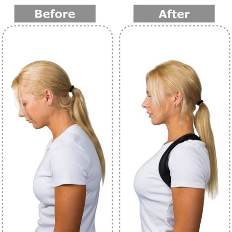 Orthopedic Best Back Brace Posture Corrector for Women & Men | One Size ...