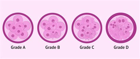 Know How Pgs Testing Improves Ivf Success Rate