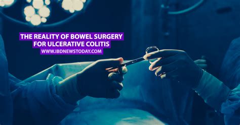 The Reality Of Bowel Surgery For Ulcerative Colitis Ibd News Today