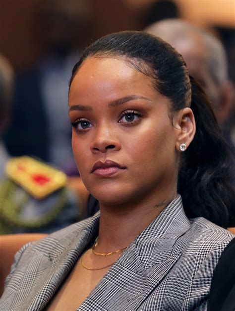 Rihanna 'bruised face' in electric scooter crash but is 'feeling fine ...