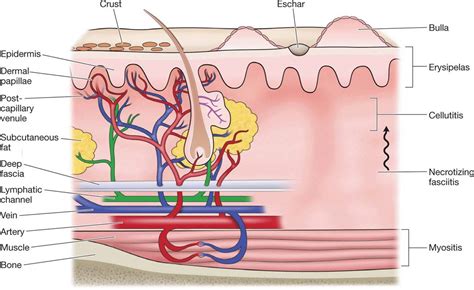 Bacterial Colonizations And Infections Of Skin And Soft Tissues