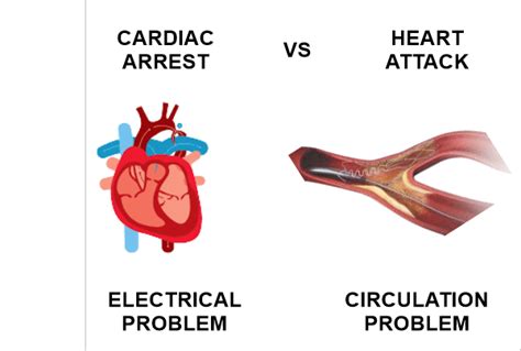 Difference Between Heart Attack And Sudden Cardiac Arrest Javatpoint