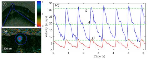 Pulsatile Flow Of A Retinal Vessel A Doppler Oct Image For A