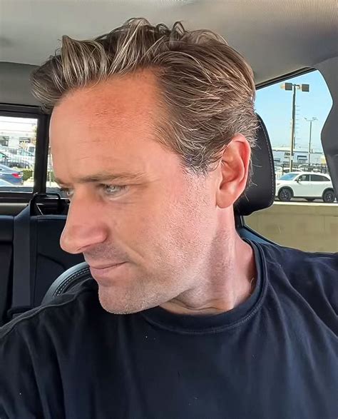 I Cant Afford It” Armie Hammer Forced To Sell Truck