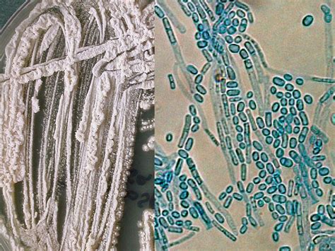 Trichosporon | Mycology | University of Adelaide