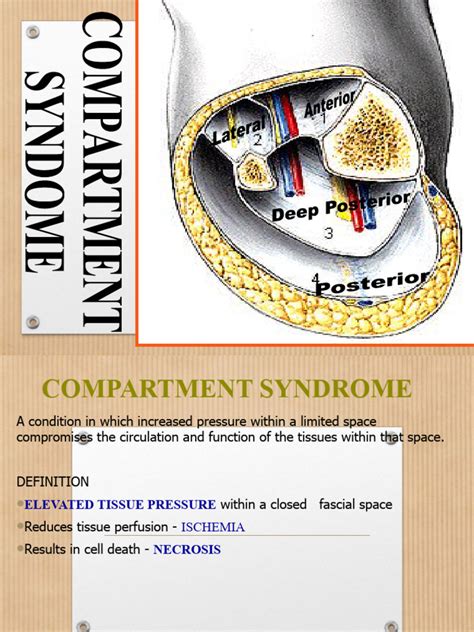 Compartment Syndrome | PDF | Human Leg | Clinical Medicine