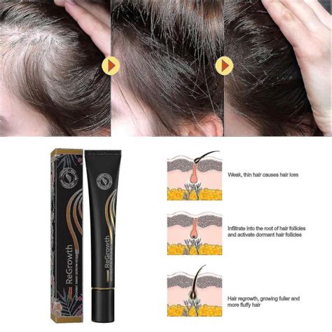 Hair Growth Serum Derma Scalp Intensive Ampoule Triple Roll Massager Fast Regrow Hair Line Anti