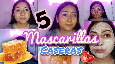 5 Mascarillas Caseras Para Tener La Piel Perfecta Sin Acne Y Sin