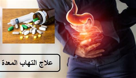 علاج التهاب معدة وكيف تقضي عليه في أسرع وقت؟