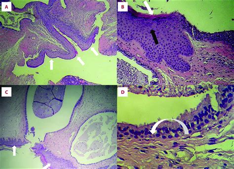 Histological Findings With Hematoxylin And Eosin Staining A