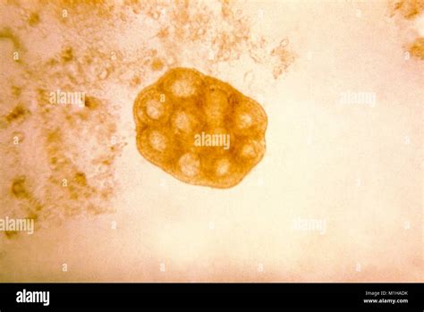 Photomicrograph Of An Egg Packet That Has Been Released From A