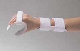 Module 3 STATIC SPLINTS Flashcards Quizlet