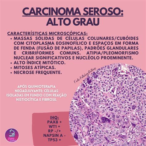 Carcinomas De Ov Rio Tipos Histol Gicos E Perfil Imunoistoqu Mico