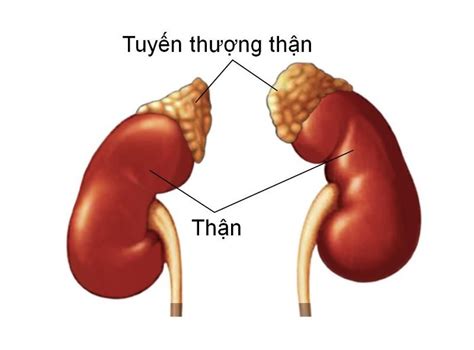 Suy tuyến thượng thận nguy hiểm thế nào Các thuốc dùng để chữa TRUNG