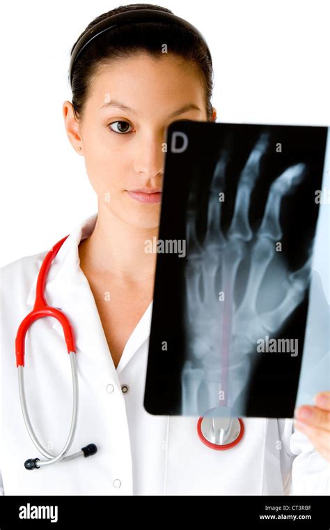 X Ray Normal Hand Hi Res Stock Photography And Images Alamy