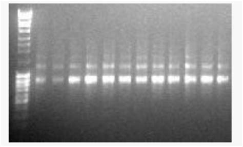 can someone help indicate the sizes of the dna | Chegg.com