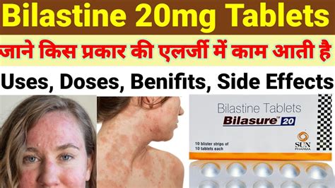 Bilastine Tablet Bilastine 20 Mg Bilastine Tablets 20 Mg Uses Dose