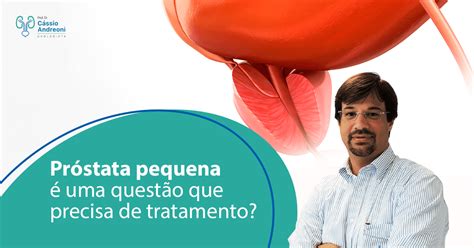 Próstata Pequena é Uma Questão Que Precisa De Tratamento Dr Cássio Andreoni Urologista Crm 78546