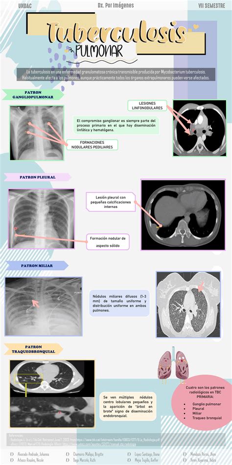 TBC Pulmonar Poster Oficial Tuberculosis Pulmonar PATRON