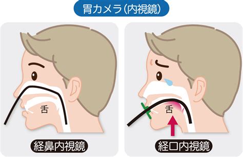 胃カメラとは？費用や検査でわかることなどを解説 ヒロオカクリニック