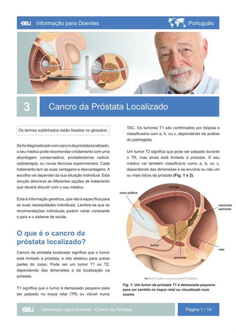 PDF Informação para Doentes Português patients uroweb org Sistema