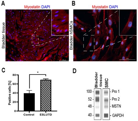 Ijms Free Full Text Myostatin Overexpression And Smad Pathway In