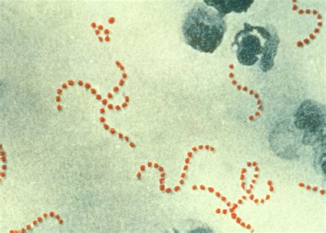 Group B Streptococcal Infections